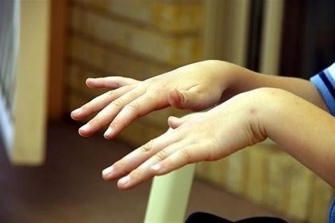 Як боротися з тремтінням рук. Тремтіння рук може бути симптомом небезпечних хвороб.