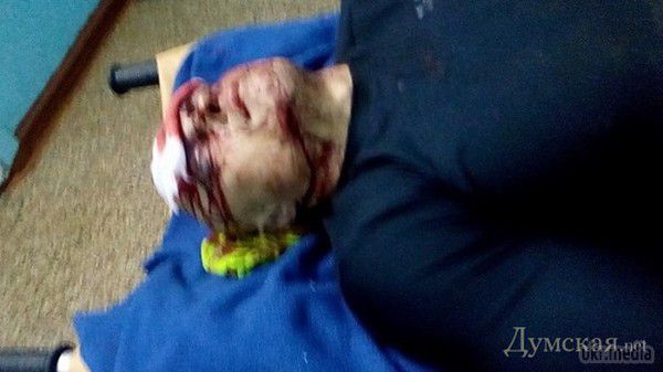 У центрі Одеси жорстоко побили «євромайданівця», проломили череп. Увечері 10 грудня в центрі Одеси група невідомих жорстоко побила активіста «евромайдана».