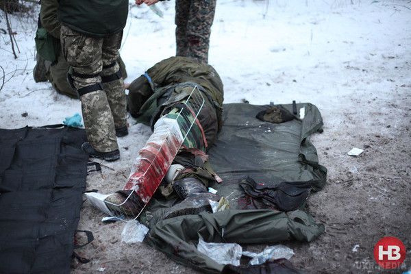 Порятунок поранених "кіборгів". Фоторепортаж з передової. Оскільки військовий лікар в зоні аеропорту - тільки один, безпосередньо в терміналі, всіх поранених вивозять і доставляють в найближчі лікарні.