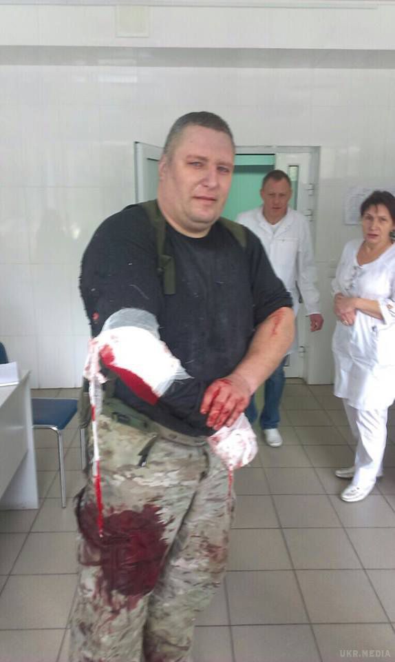 Вибух авто комбата "Слобожанщини": Янголенка і його дружину прооперували. Прокуратура кваліфікувала подію як посягання на життя співробітника правоохоронних органів