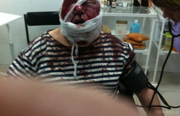 Невідомі жорстоко побили батьків депутата Харківської міськради