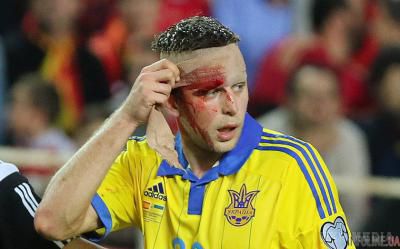 Кравцю наклали два шви, Зозуля повертається в клуб з травмою коліна. Поєдинок збірної України з іспанськими футболістами не минув без пошкоджень.