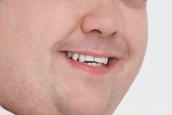 У Британії товстунам заборонили лікувати зуби. У Великобританії стоматологічна клініка з міста Ебердейр в Південному Уельсі відмовилася обслуговувати товстих людей. 