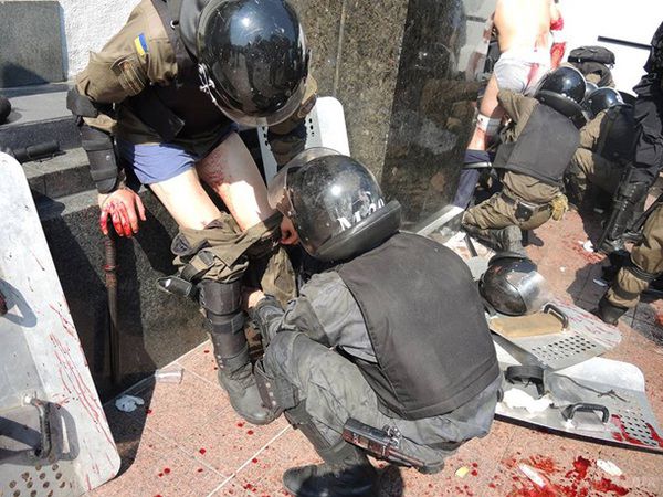 У міліцію під Верховною Радою кинули бойову гранату, десятки постраждалих (фото, відео 18+). Попередньо, постраждали більше 30 правоохоронців: у них поранення ніг, рук, очей, травми голови.