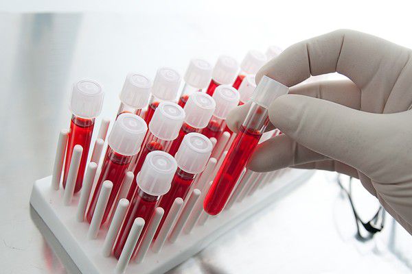  До 2019 року у США вчені створять універсальний аналіз крові на рак. Вчені з США розробляють новий універсальний тест, на основі звичайного аналізу крові, для виявлення ракових клітин на ранній стадії захворювання. Очікується, що роботи будуть повністю завершені до 2019 року.