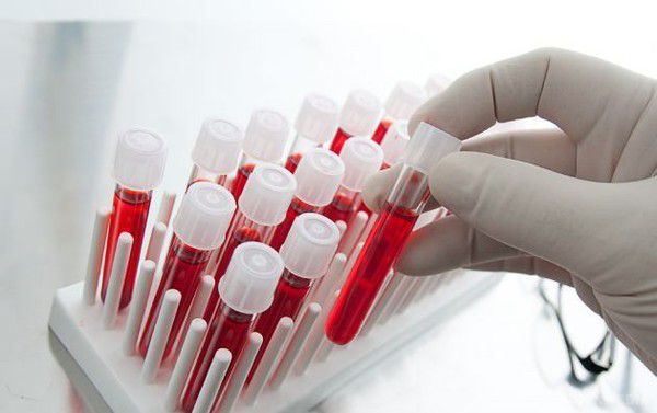 З допомогою аналізу крові можна дізнатися, чи потрібні антибіотики пацієнту. Американські вчені повідомили, що розробляють спеціальний тест, який на основі аналізу крові хворого покаже, чи потрібно йому приймати антибіотики. Даний тест допоможе уникнути безглуздого прийому препаратів хворій людині.