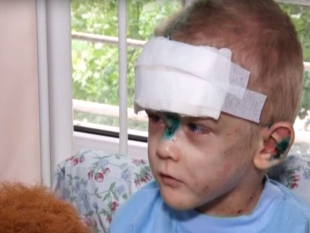 Знайдений в Одесі хлопчик розповів, хто над ним знущався (відео). З дитиною працював психолог, якому малюк і зізнався у тому, що так жорстоко з ним обійшлася його мати.