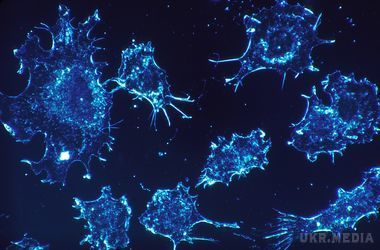 Вчені з'ясували, як можна заразитися на рак. Розвиток онкології пов'язаний також з вірусом Епштейна-Барра.