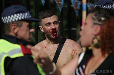 Кривава бійня в Лондоні: постраждали десятки поліцейських. Карнавал в Лондоні перетворився на криваве побоїще.