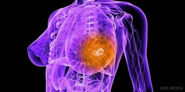 Вчені з'ясували, що провокує рак грудей. Відомо, що бактеріальний фон існує в кишечнику людини, нещодавно вчені з'ясували, що аналогічний фон є й у молочних залозах.