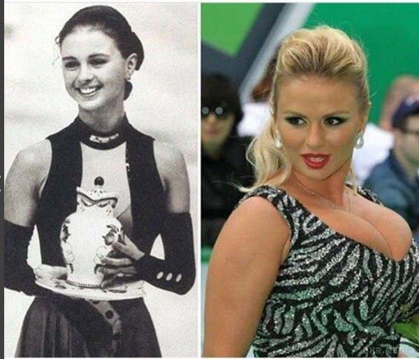 В зірки шоу-бізнесу в юності  була звичайнісінька маленька грудь. Коли Семенович поринула у світ шоу-бізнесу, довелося закинути спорт, після чого центром уваги стала її великі груди.