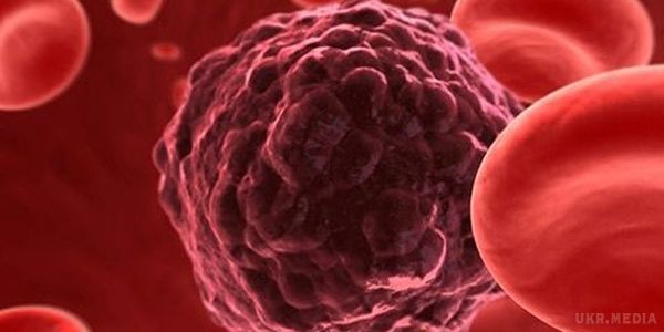 Світила світової онкології назвали найнадійніші способи, як уберегтися від раку. На міжнародному онкологічному конгресі ESMO, який завершився нещодавно в Копенгагені, пролунало дві головних висновки-новини: як водиться, хороша і погана.