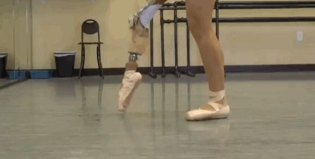Вона не здалася: дівчинка, якій ампутували ногу через рак, продовжила танцювати (фото). Ніщо на світі не здатне змусити 15-річну Габі (Gabi Shull) кинути заняття танцями, навіть рак. 