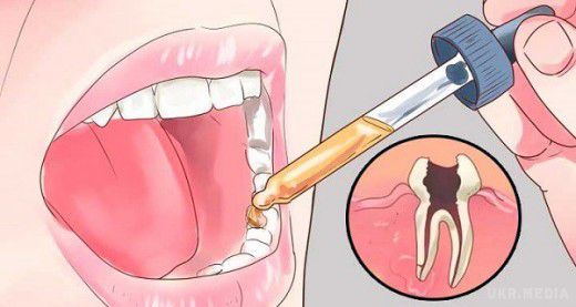 Прополощіть цим рот і зубний біль пройде протягом декількох секунд!. Однією з найгірших і найбільш дратівливих болів є зубний біль, терпіти яку буває зовсім несила.