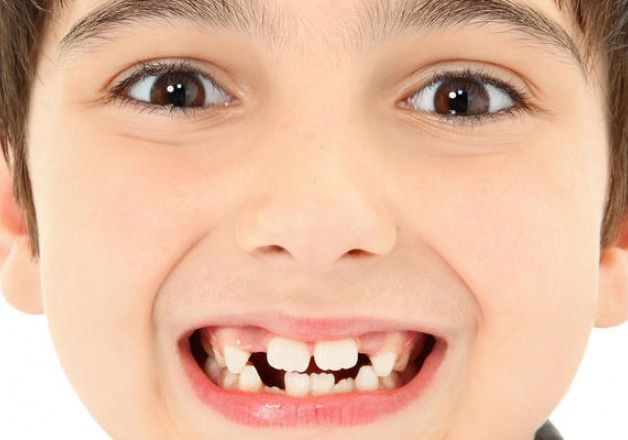 Питання, чи варто лікувати молочні зуби, виникає практично у всіх батьків. Багато батьків вважають, що лікувати молочні зуби не потрібно, тому що вони все одно випадуть. 