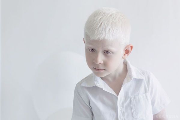 Тендітна краса: дивовижні портрети альбіносів, які так не схожі на нас(фото). За статистикою, на 20 тисяч дітей, що з'являються на світ у Європі і Північній Америці, припадає один альбінос. 