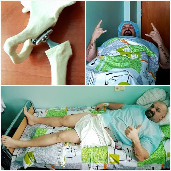 Вірастюк пережив складну операцію. Український богатир лежить в інституті травматології