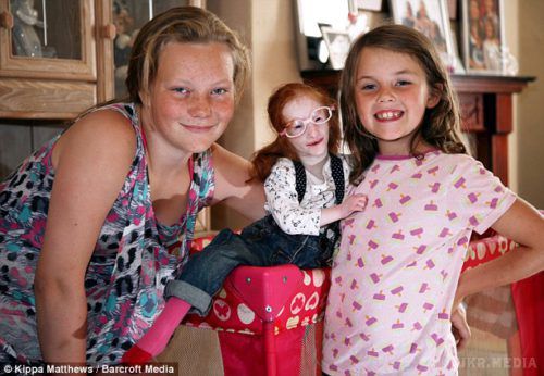 Неймовірно крихітна 5-річна дівчинка: історія, що шокує (фото). Лікарі були переконані, що дитина не проживе і півроку.