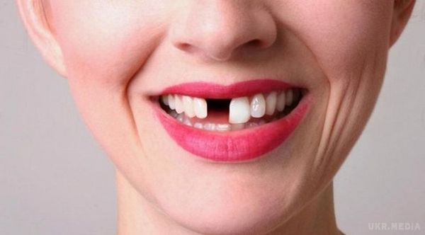 Кількість випавших  зубів допоможе визначити решту тривалість життя людини. До такого висновку прийшли дослідники з Oral Health Foundation у Великобританії.