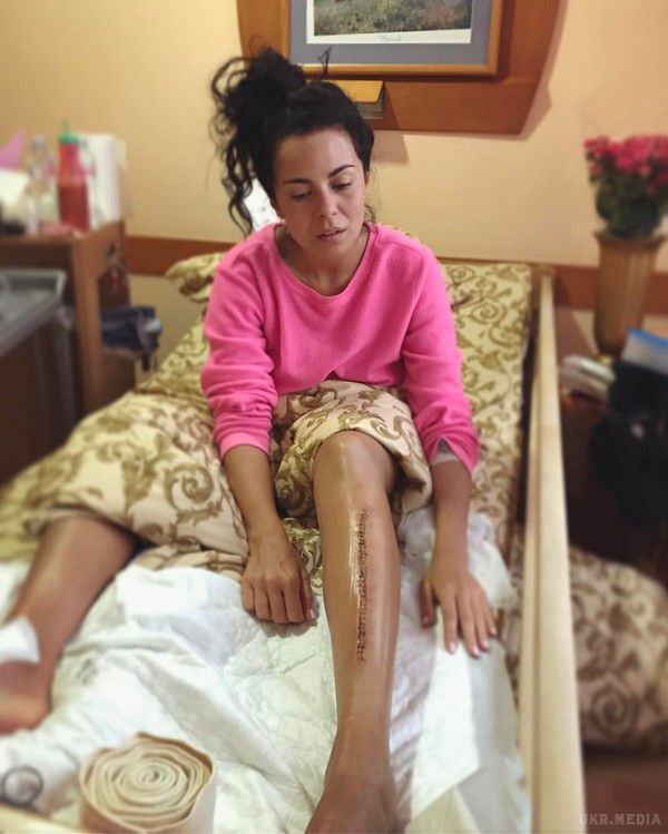 Настя Каменських шокувала шрамами на ногах (відео, фото). 2 лютого українська співачка Настя у своєму новому відеоблозі розповіла про самопочуття після нещодавньої операції на ногах.