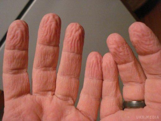 Чому шкіра на пальцях зморщується у воді? В житті не здогадаєтеся. Кожен з нас з раннього дитинства знає, що від довгого перебування у воді шкіра на пальцях починає кривитися. 