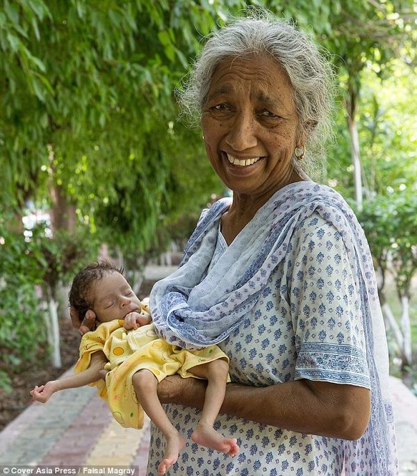 Індіанка стала матір'ю в 72 роки: наслідки пізніх пологів (фото). Мешканка Індії, яка вперше стала матір'ю в 72 роки, розповіла про те, як пізні пологи вплинули на стан її здоров'я.