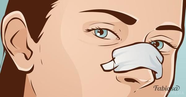 Більшість людей допускають цю помилку, коли хочуть зупинити кров з носа. Носові кровотечі - це дуже поширена річ. 