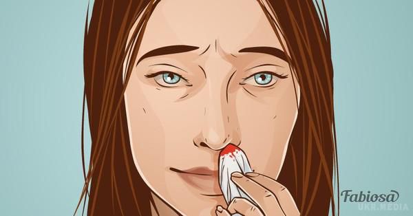 Більшість людей допускають цю помилку, коли хочуть зупинити кров з носа. Носові кровотечі - це дуже поширена річ. 