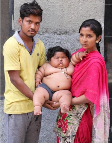 В Індії восьмимісячна малятко важить 20 кілограмів. В Індії лікарі зі штату Пенджаб стурбовані станом здоров'я восьмимісячної дівчинки Чахат Кумар, яка страждає від морбидного ожиріння.