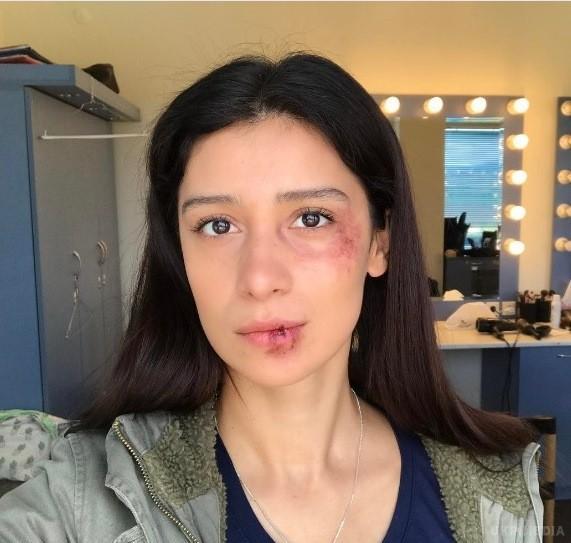 Равшана Куркова показала побите обличчя в Instagram. Равшана Куркова опублікувала у своєму Інстаграм новий знімок, яким шокувала своїх фанатів. Багато з них не здогадалися, що синець і розбита губа – грим.