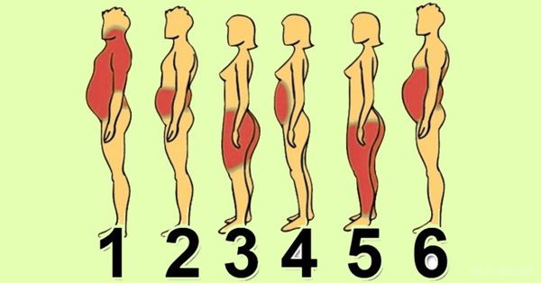 6 типів ожиріння: про що говорять зайві сантиметри на твоєму тілі. Ожиріння - це одне з найпоширеніших обмінних захворювань.