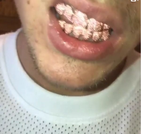 Джастін Бібер зробив собі рожеві зуби з сапфірами за 15 тисяч доларів. Робота лос-анджелеського ювеліра обійшлася музикантові в 15 тисяч американських доларів
