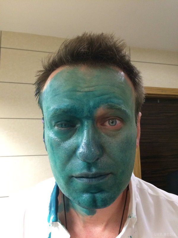 Навальному вперше за 5 років видали закордонний паспорт. Тепер він збирається поїхати на лікування за кордон.