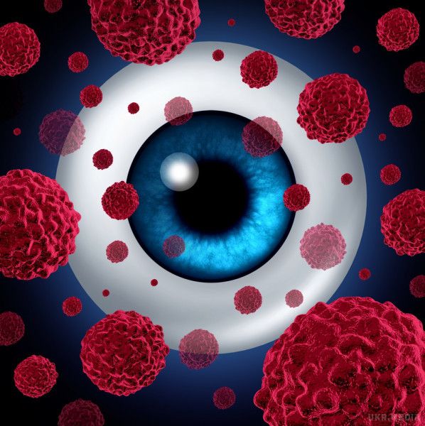 У "чорнобильських" євреїв знайшли рідкісний рак ока. При цьому відзначається, що протягом 20 років вітрео-ретинальна лімфома була виявлена тільки в декількох випадках, і лікарями очікувалося виявлення 2-3 випадків цього захворювання.