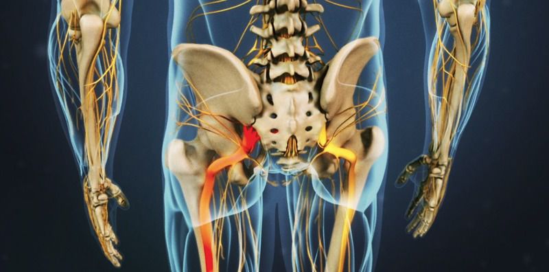 Тенісний м'яч — ефективний засіб подолати біль у спині. Таке захворювання, як радикуліт, або запалення сідничного нерва, зазвичай починається непомітно: втома і швидка стомлюваність ніг, поколювання і «мурашки» в м'язах.