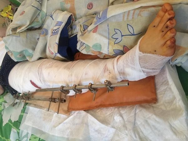 Потрібна допомога: у Київ доставили борт з тяжкопораненими бійцями. Про це у своєму Facebook повідомила волонтер Наталя Юсупова.