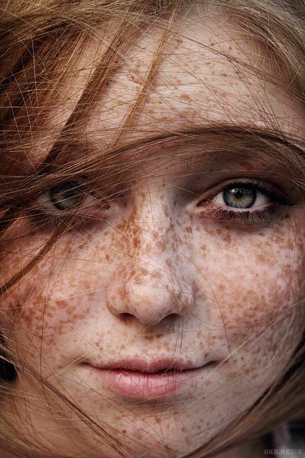 Літні красуні: красиві дівчата в ластовинні (Фото). Якщо дівчина від природи рудоволоса, то її шкіра, найчастіше, вся покрита ластовинням.