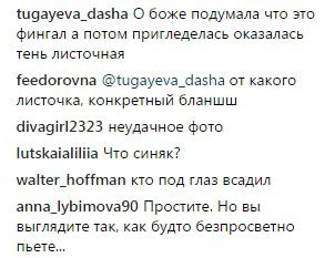"Синець на пів обличчя": Могилевська стривожила фанатів дивним фото. Знімок співачка опублікувала у своєму Instagram-акаунті.