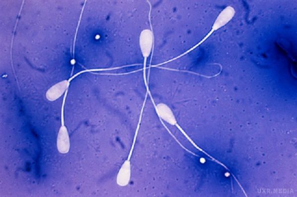 У кого найбільші сперматозоїди і яйцеклітини?. Сперматозоїд — найменша клітина в людському тілі, і в той же час одна з найбільш складних. Яйцеклітина, навпаки, — найбільша, але не менш складна. Якщо ж ми кинемо погляд на те, якими бувають статеві клітини (або гамети) у представників тваринного світу, ми виявимо, що їх різноманітність просто вражає.