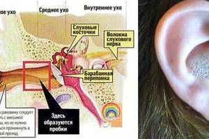 Корисні поради для промивання вуха