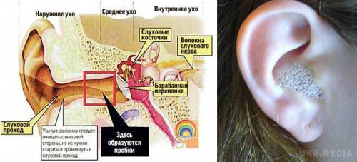 Секрети чистки вуха перекиснем водню. Дехто вважає, що цей розчин може пошкодити шкіру вуха, слуховий прохід і особливо барабанну перепонку.