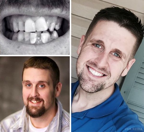 40 дивовижних випадків, коли стоматологи творили чудеса. Як же пощастило тим щасливчикам, у яких з народження рівні і красиві зуби.
