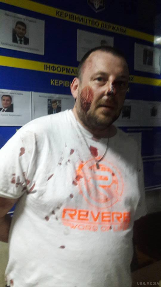 У Києві "копи" побили бійців АТО. Інцидент стався в столичному закладі.
