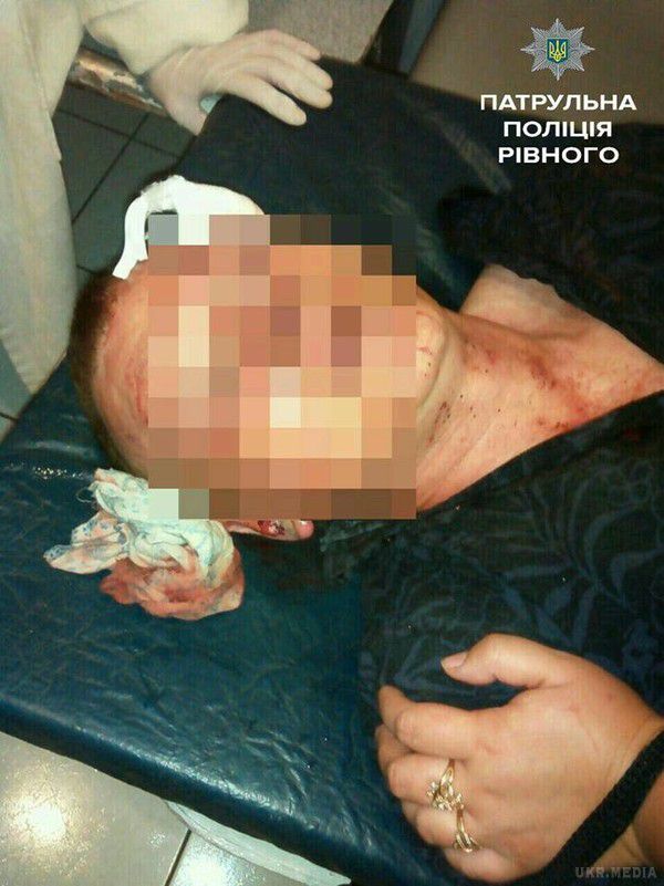 У Рівному іноземець жорстоко побив бійця з Донбасу. Військовий заступився за місцеву дівчину, з якою громадянин Азербайджану поводився зухвало.