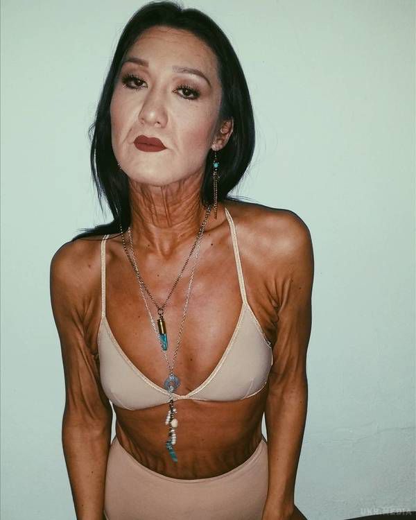 26-річна модель із рідкісною хворобою шкіри вразила світ. Шокуючі фото. Сара Герц у свої 26 років страждає невиліковним захворюванням – синдромом Елерса-Данлоса.