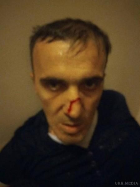 В Одеській області поліція шукає людей, які постраждали від дій цієї банди(фото).  Під час "роботи" нападники використовували виключно автівки марки "Мерседес".