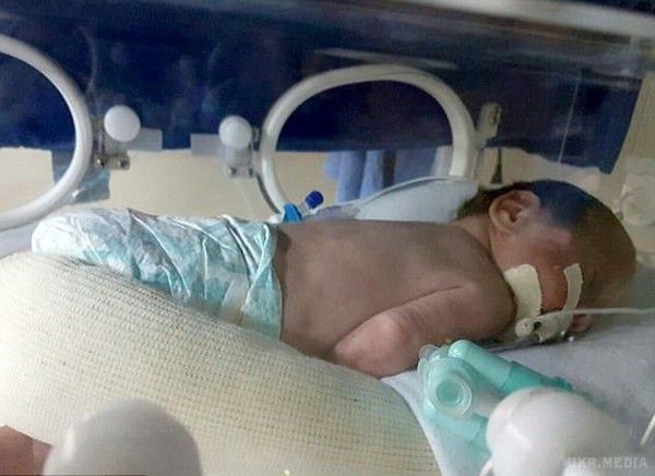 Жінка народила двійню через 4 місяці після власної смерті - Бразильське диво. Завдяки бразильським мед. працівникам дівчина, яка загинула від інсульту, перебуваючи на дев'ятому тижні вагітності, 4 місяці по тому, подарувала життя двом дітям.