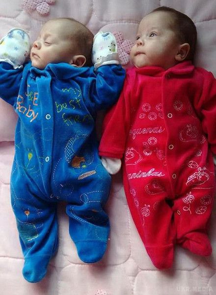 У Бразилії лікарям вдалося виростити близнюків в утробі мертвої жінки. Після смерті мозку, лікарі вирішили не відключати жінку він приладів штучного життєзабезпечення, адже близнюки були ще живі. 
