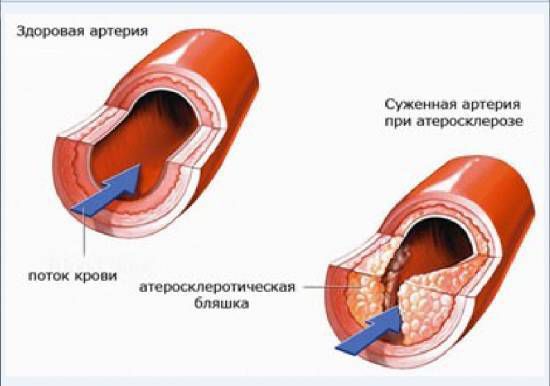 Наука. Найбільша афера XX століття. Відомий віденський хірург і вчений Теодор Більрот (добре відомий авторськими операціями з видалення частини шлунка при виразковій хворобі) попросив своїх учнів провести цікавий досвід.