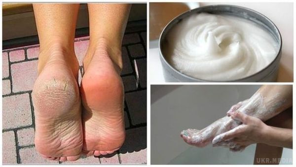 Домашнє засіб для усунення мозолів і грибків з ніг. Частота грибків у нігтях і ногах пов'язана головним чином з використанням взуття і синтетичних панчіх, а також в громадських місцях, таких як ванні кімнати і басейни.